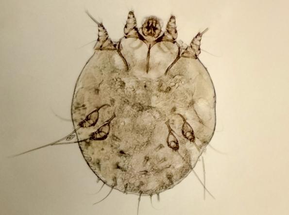 疥癬蟲治療 疥癬蟲治療