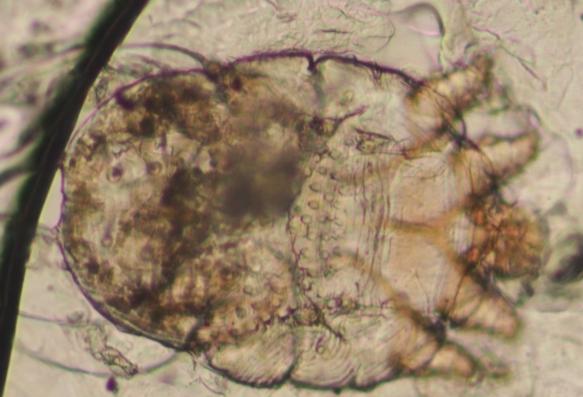 疥癬蟲預防 疥癬蟲預防
